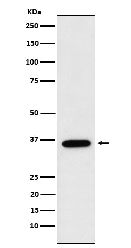 Anti-FBP1 Rabbit Monoclonal Antibody