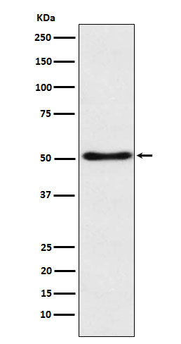 Anti-SFRP4 Rabbit Monoclonal Antibody