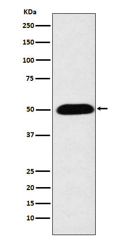 Anti-Cytochrome P450 27A1 Rabbit Monoclonal Antibody