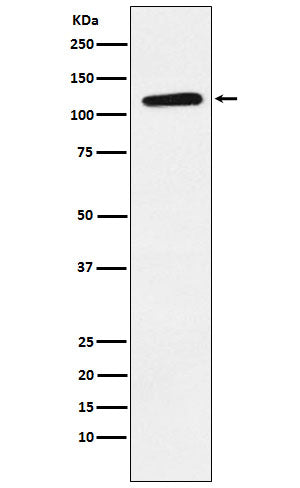 Anti-Ephrin Receptor B1 Rabbit Monoclonal Antibody
