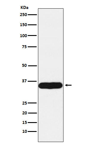 Anti-Tropomyosin alpha 1 Chain Rabbit Monoclonal Antibody