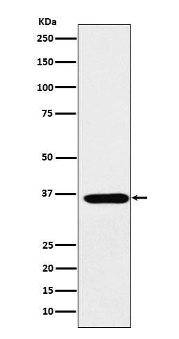 Anti-SMN Rabbit Monoclonal Antibody
