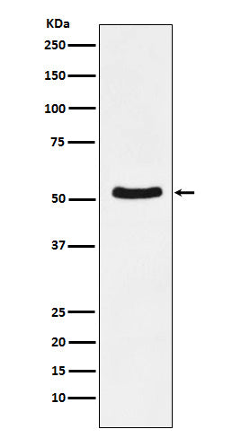 Anti-DDX6 Rabbit Monoclonal Antibody