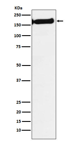 Anti-SF3B1 Rabbit Monoclonal Antibody