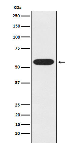 Anti-UAP1 Rabbit Monoclonal Antibody