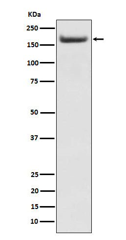 Anti-IRS2 Rabbit Monoclonal Antibody