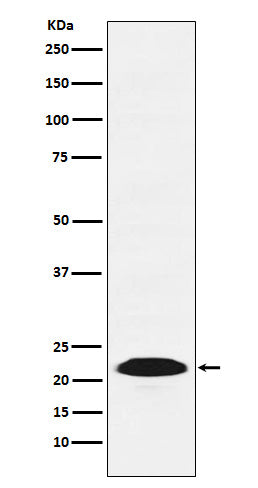 Anti-Proteasome beta 9 Rabbit Monoclonal Antibody