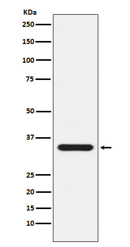 Anti-Presenilin 1 Rabbit Monoclonal Antibody
