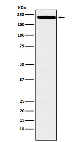 Anti-ZEB1 Rabbit Monoclonal Antibody