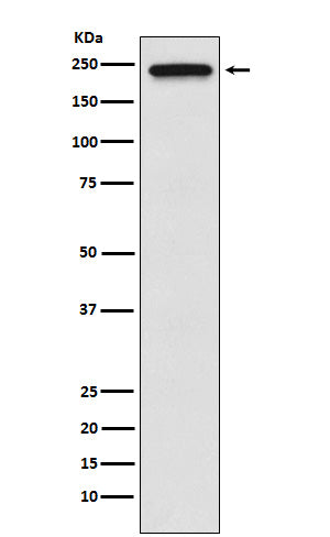 Anti-TRPM7 Rabbit Monoclonal Antibody