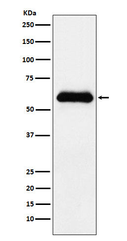 Anti-AACT Rabbit Monoclonal Antibody