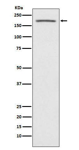 Anti-Angiotensin Converting Enzyme 1 Rabbit Monoclonal Antibody