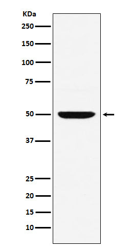 Anti-Interferon Regulatory Factor 4 Rabbit Monoclonal Antibody
