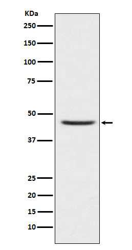 Anti-CCR8 Rabbit Monoclonal Antibody