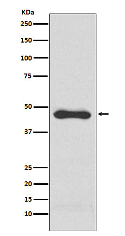 Anti-PAI1 Rabbit Monoclonal Antibody