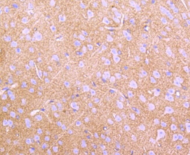 Anti-EAAT1 Rabbit Monoclonal Antibody