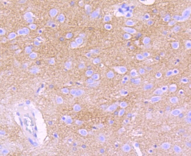 Anti-EAAT1 Rabbit Monoclonal Antibody