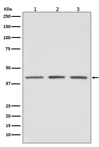Anti-PRMT1 Rabbit Monoclonal Antibody