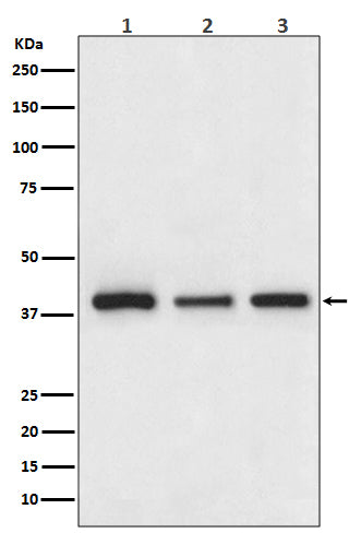 Anti-Cathepsin L/V/K/H Rabbit Monoclonal Antibody