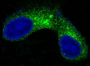 Anti-Carcino Embryonic Antigen CEA (CD66e) Rabbit Monoclonal Antibody