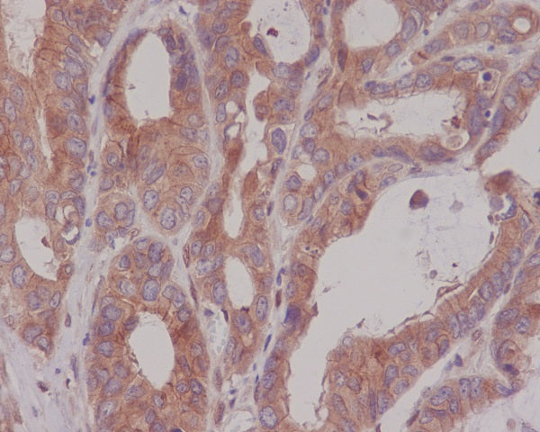 Anti-Carcino Embryonic Antigen CEA (CD66e) Rabbit Monoclonal Antibody