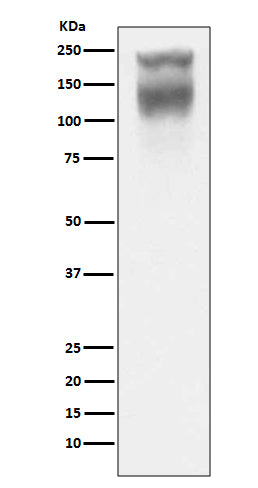 Anti-Carcino Embryonic Antigen CEA (CD66e) Rabbit Monoclonal Antibody