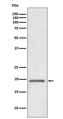 Anti-HE4 Rabbit Monoclonal Antibody