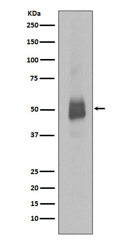 Anti-Phospho-Lyn (Tyr396) Rabbit Monoclonal Antibody