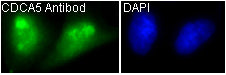 Anti-CDCA5 Rabbit Monoclonal Antibody