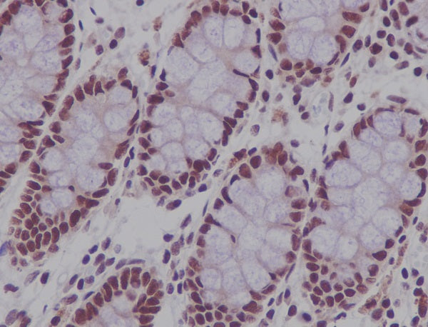 Anti-CDCA5 Rabbit Monoclonal Antibody
