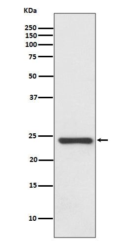Anti-HspB8 Rabbit Monoclonal Antibody