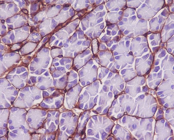 Anti-Collagen VI alpha 1/2/3 Rabbit Monoclonal Antibody