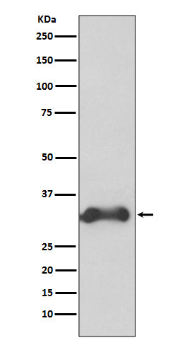 Anti-Cyclin D3 Rabbit Monoclonal Antibody