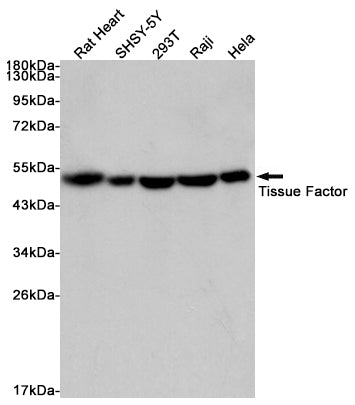 Anti-Tissue Factor Rabbit Monoclonal Antibody