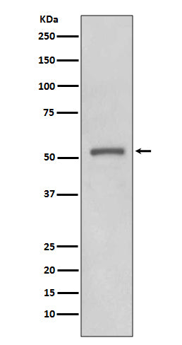 Anti-MMP11 Rabbit Monoclonal Antibody