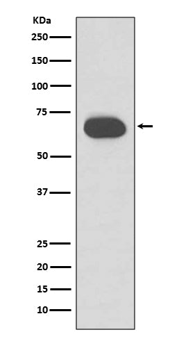 Anti-Cytokeratin 1 Rabbit Monoclonal Antibody