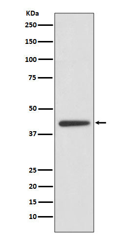 Anti-Adiponectin Receptor 1 Rabbit Monoclonal Antibody