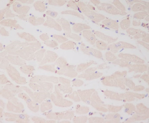 Anti-MYL2 Rabbit Monoclonal Antibody