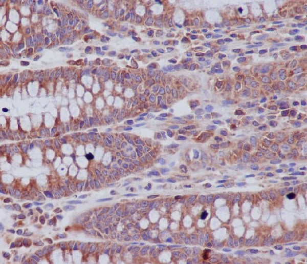 Anti-ABCF1 Rabbit Monoclonal Antibody