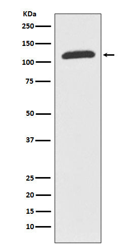 Anti-ABCF1 Rabbit Monoclonal Antibody