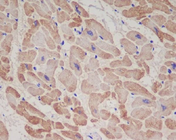 Anti-Cardiac Troponin T Rabbit Monoclonal Antibody