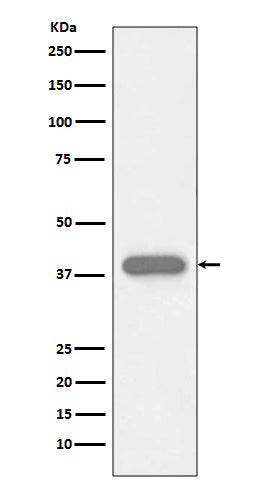 Anti-Cardiac Troponin T Rabbit Monoclonal Antibody