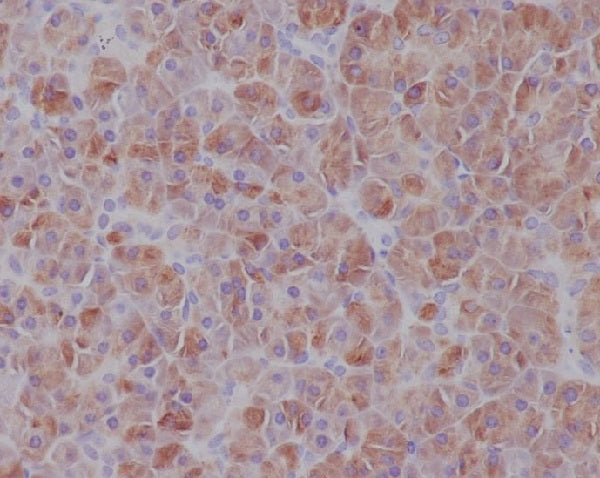 Anti-IRF7 Rabbit Monoclonal Antibody