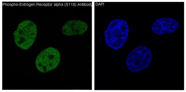 Anti-Phospho-Estrogen Receptor alpha (Ser118) Rabbit Monoclonal Antibody