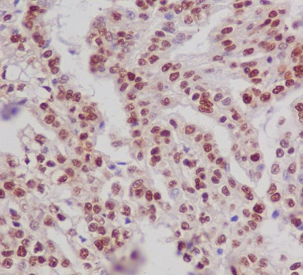 Anti-Phospho-Estrogen Receptor alpha (Ser118) Rabbit Monoclonal Antibody