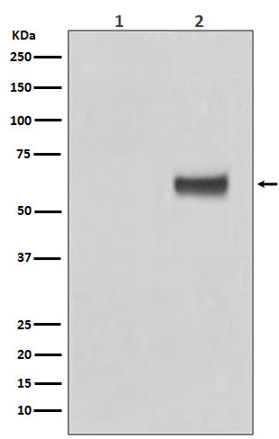 Anti-Phospho-Estrogen Receptor alpha (Ser118) Rabbit Monoclonal Antibody