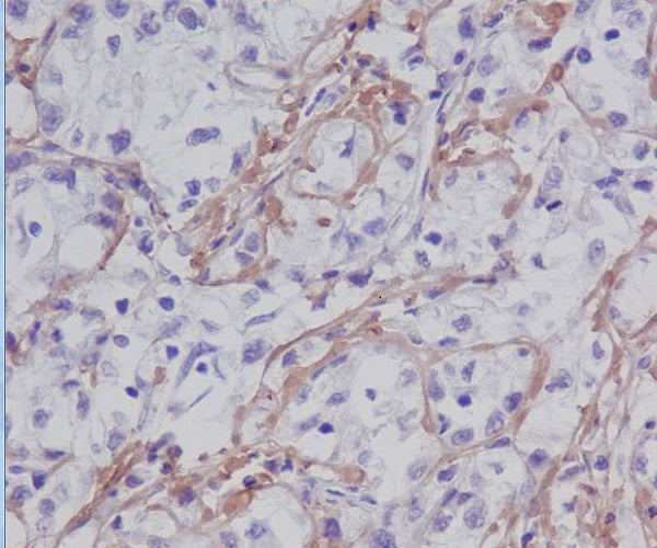 Anti-Fibronectin Rabbit Monoclonal Antibody