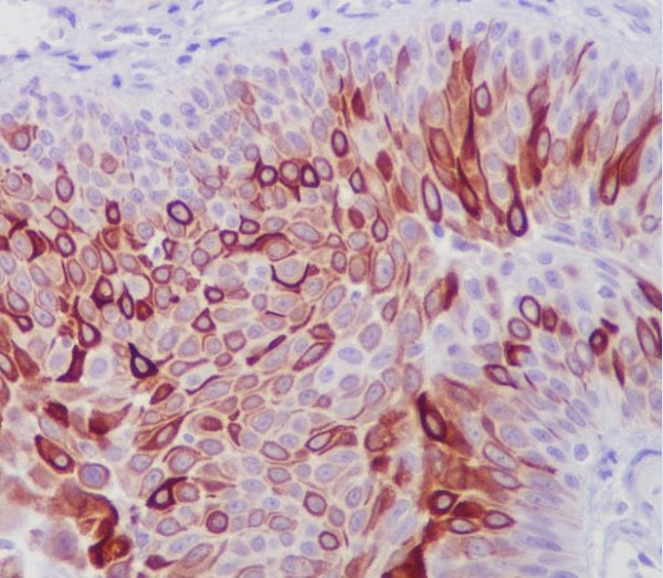 Anti-Cytokeratin 10 Rabbit Monoclonal Antibody