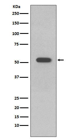 Anti-Cytokeratin 10 Rabbit Monoclonal Antibody