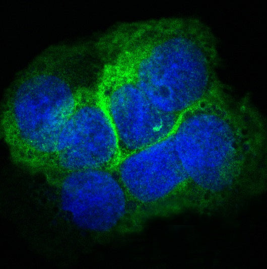 Anti-Collagen XVII alpha 1 Rabbit Monoclonal Antibody
